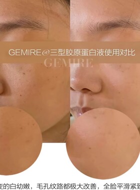 【三型胶原蛋白液】反馈 好评不断