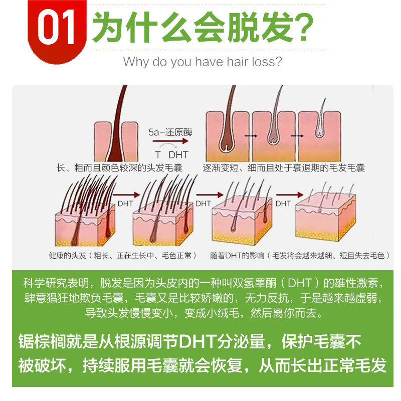 4瓶绿色非那雄胺防脱发美国软胶囊 普丽普莱金人海外锯棕榈