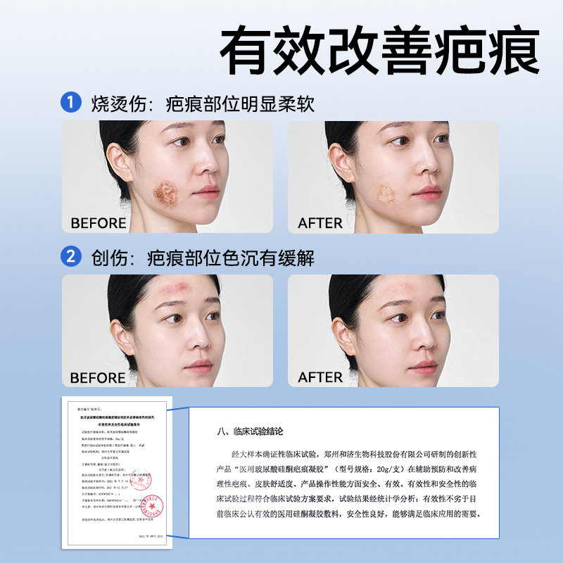 振德医用透明质酸硅酮凝胶剖腹产双眼皮疤痕修复除疤祛疤膏