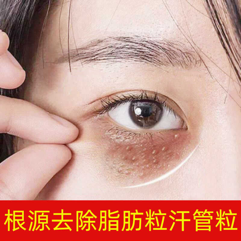 脂肪粒去除眼部 新人首单立减十元 21年8月 淘宝海外