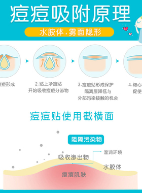 【香菇双11】护妍天使隐形痘痘贴水杨酸48x2+综合18x2
