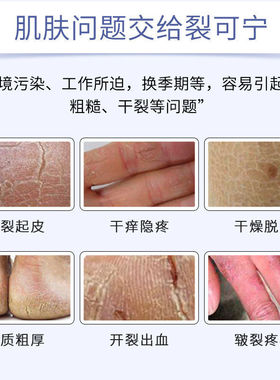 隆力奇裂可宁霜防裂护足霜护手霜滋润保湿防干燥防皴防裂膏蛇油膏