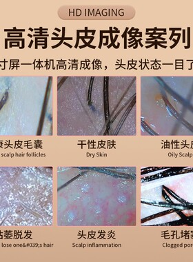 热销高清头皮检测仪防脱养发