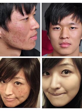 官方正品佰草世家洗面奶男女学生氨基酸洁面乳保湿淡化黑色素痘印