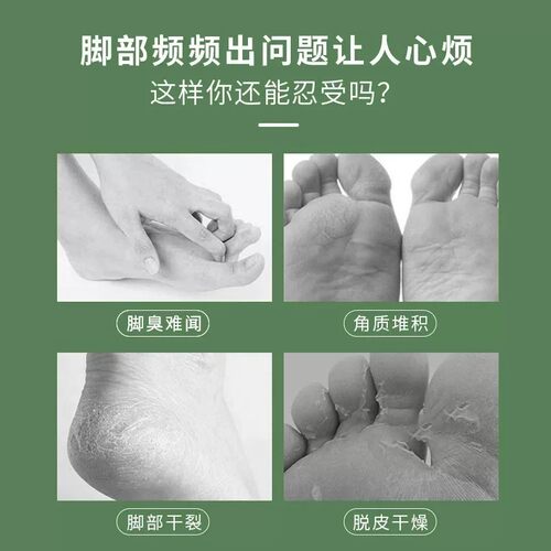 足膜脚膜去死皮脚气加长套脚后跟治疗脚气脚痒脱皮真菌感染水泡型 - 图2