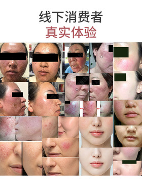 嘉怡予颜堂角质层增厚红血丝舒缓