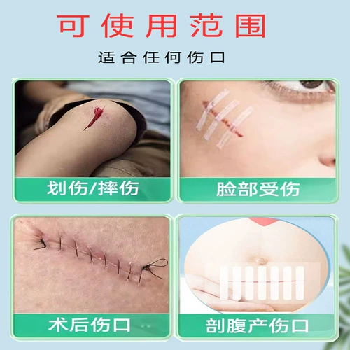 Лента, косметический подтягивающий послеродовой бондаж