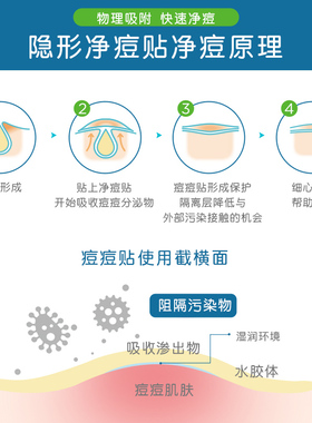 【水杨酸传明酸积雪草】护妍天使痘痘贴隐形净痘吸脓去消祛青春痘