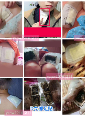 d女郎足贴汴禧金箔足膜同款足贴支持验货专柜正品包邮实体店销售