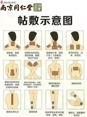 Нанкин Тонгрентанг имбирный пятно на колене колена шейки матки