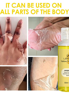 Yellow Peeling Oil Dark Skin Bleaching Remove Arm Knee Legs