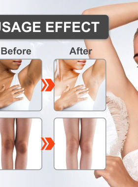Whitening Cream Private Parts Underarm Bleaching Serum White