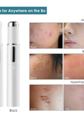 Heath Blue Light Therapy Varicose Ve Treatment Laser Pen Sof