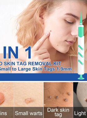 2-IN-1 Auto Skin Tag Removal Tool Kit Painless Mole Acne War
