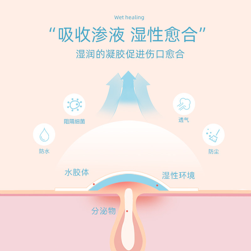 康力迪护理型净痘隐形贴预防 康力迪医疗器械伤口敷料