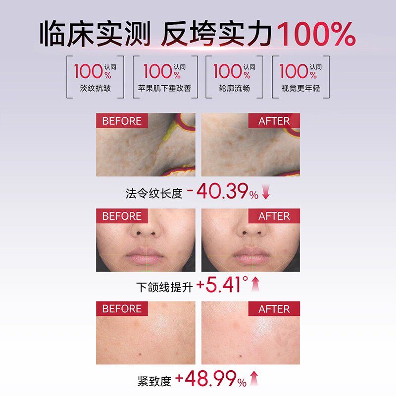 【徐璐同款】AMIRO觅光三文鱼水光仪家用美容仪无痛次抛精华套组