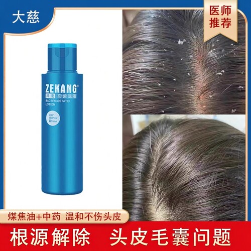 优亭泽康抑菌洗液煤焦油新洗剂抑制马拉色菌止痒大慈官方旗舰店 - 图2