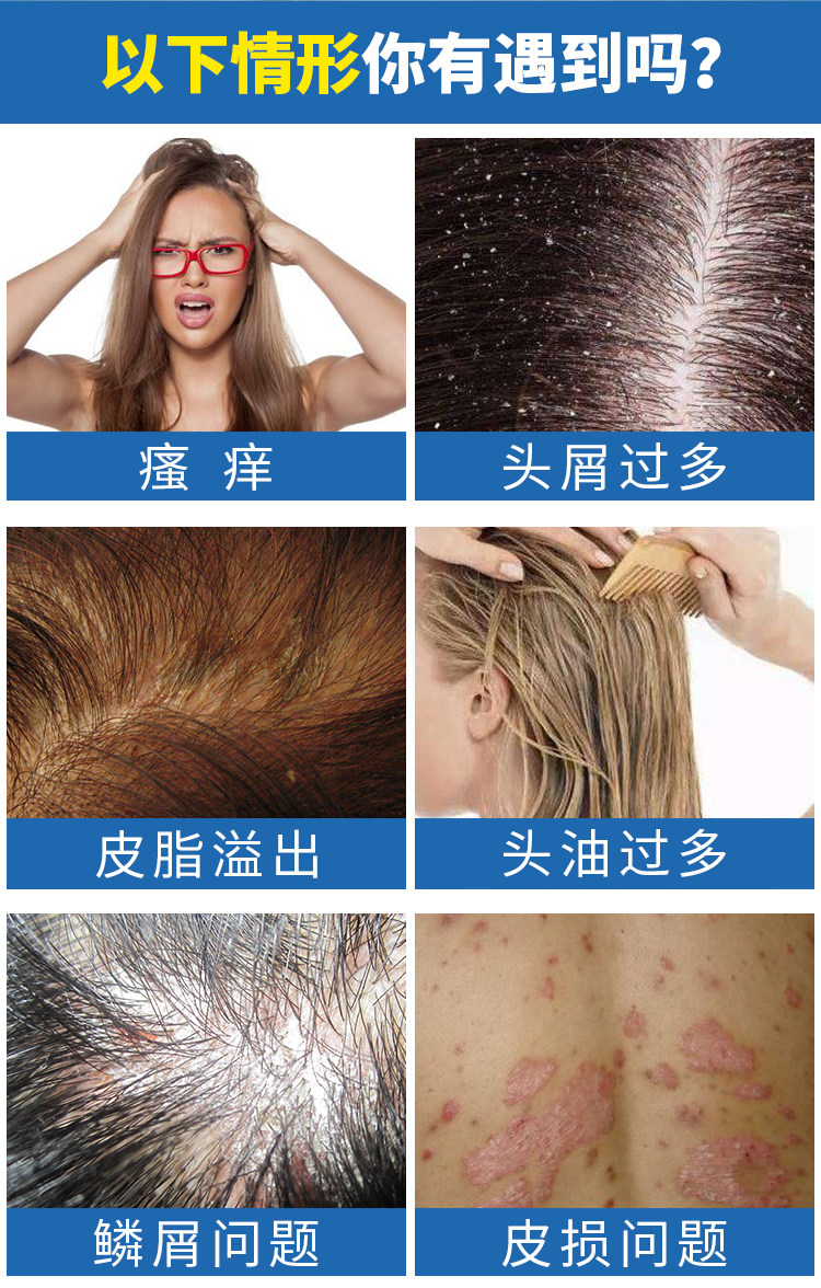 头皮毛囊炎止痒去屑头部背部真洗剂 大慈皮肤消毒护理（消）
