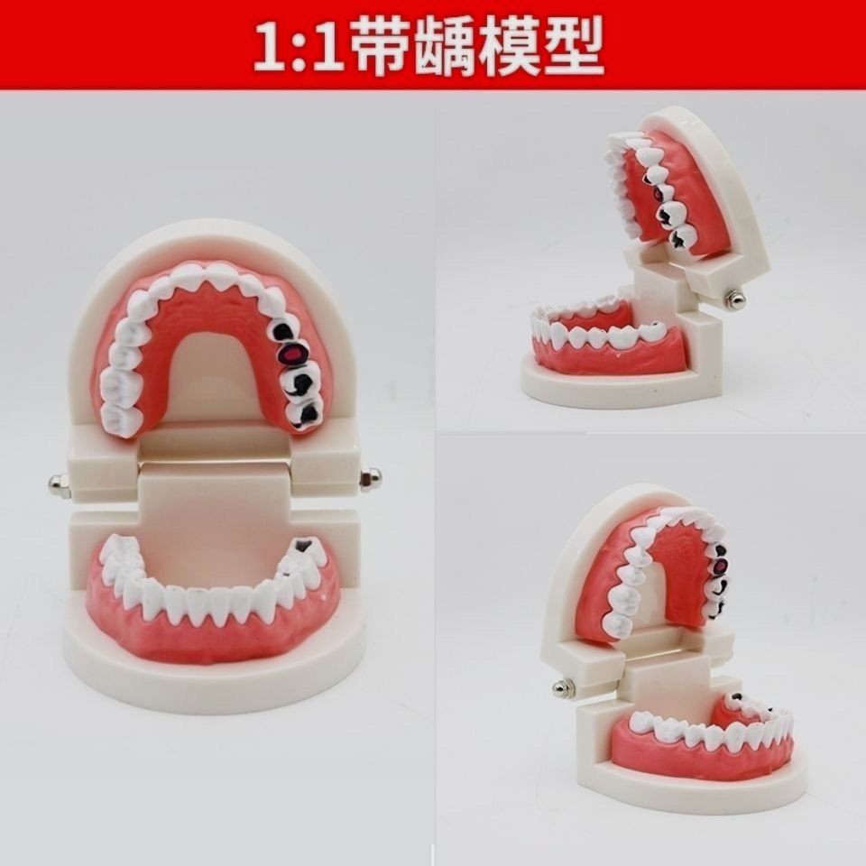牙科标准牙模型牙齿模型牙模教学假牙幼儿园刷牙练习口腔模型 - 图3