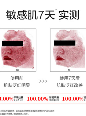 九妍保湿贻贝护肤精华油滋润精油浓缩修护改善敏感肌护理粗糙干燥