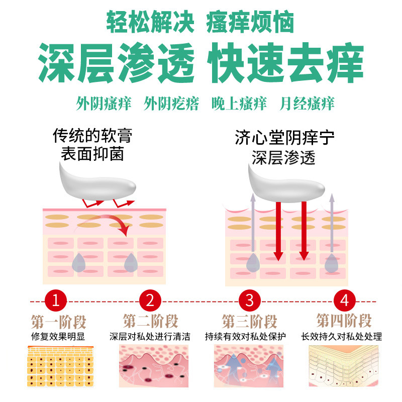 济心堂阴痒宁外阴肛门草本抑菌膏 济心堂皮肤消毒护理（消）