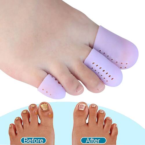 Pexmen 2Pcs Upgrade Gel Toe Protector Silicone Toe Caps - 图2