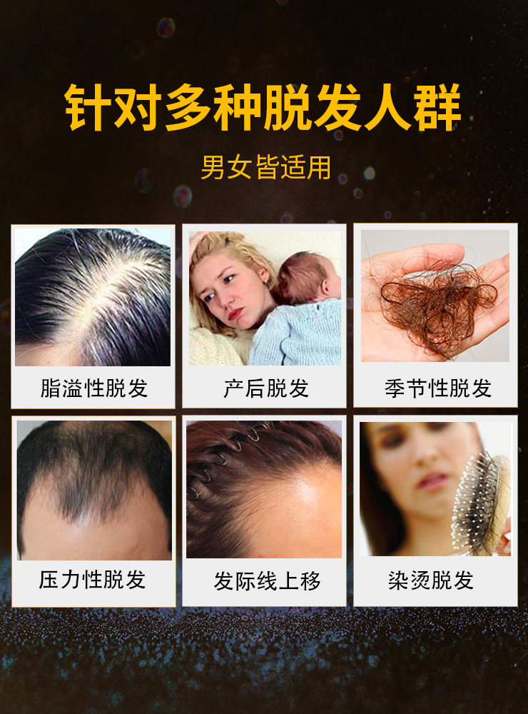 法国biotin生物素hb6b7防脱发男性 YvesPonroy海外其它植物提取物