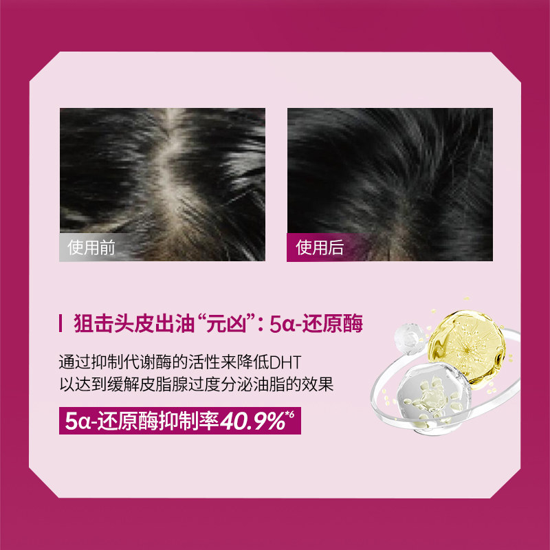 Diane黛丝恩致美洗发水护发素多重护发精油控油防脱生发官方正品