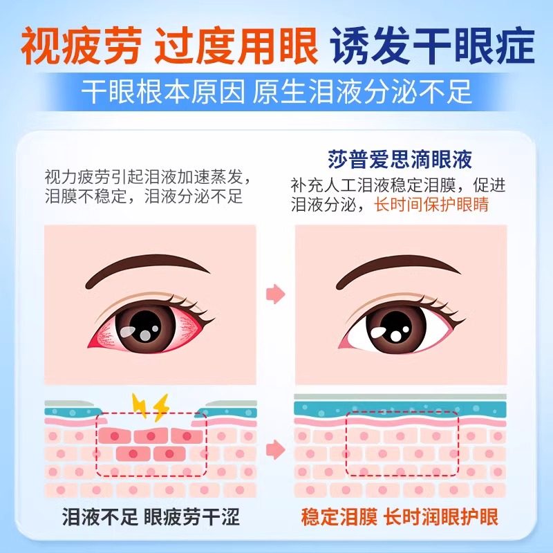 莎普爱思玻璃酸钠滴眼液人工泪液0.4ml*10支/盒缓解眼疲劳眼药水