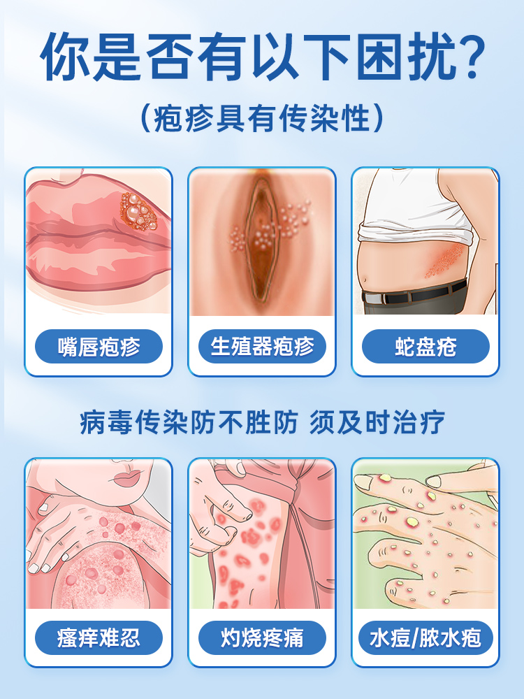 阿西洛伟乳膏阿昔洛韦软膏正品片嘴唇生殖器带状疱疹抗病毒口服液 - 图0