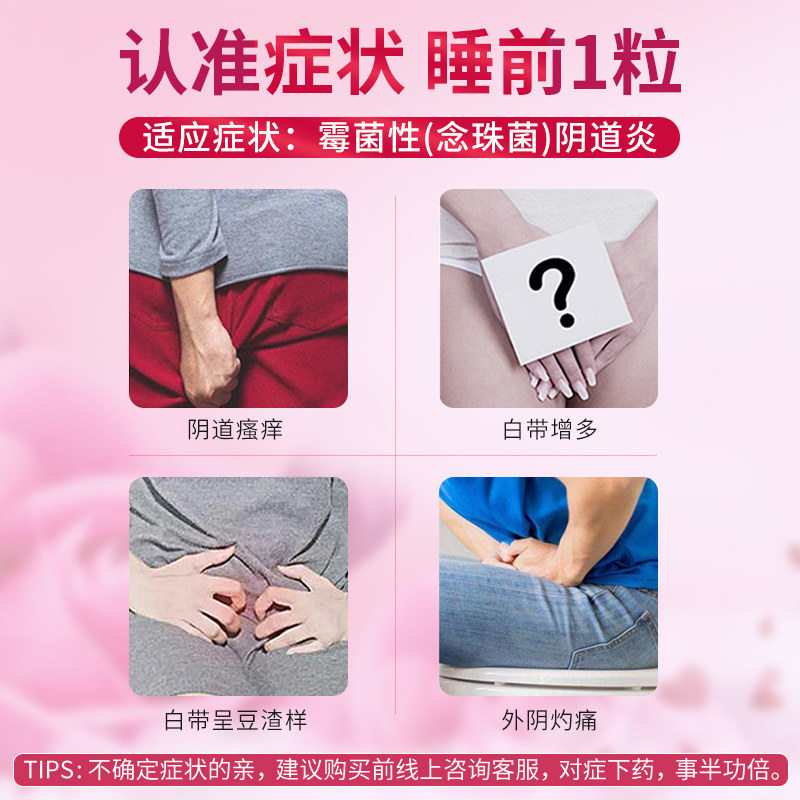 阴片道片栓剂妇科药阴道栓克霉唑 恩威妇科用药
