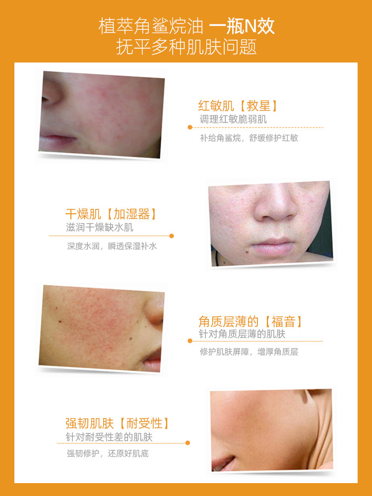  娇兰佳人化妆品精华油