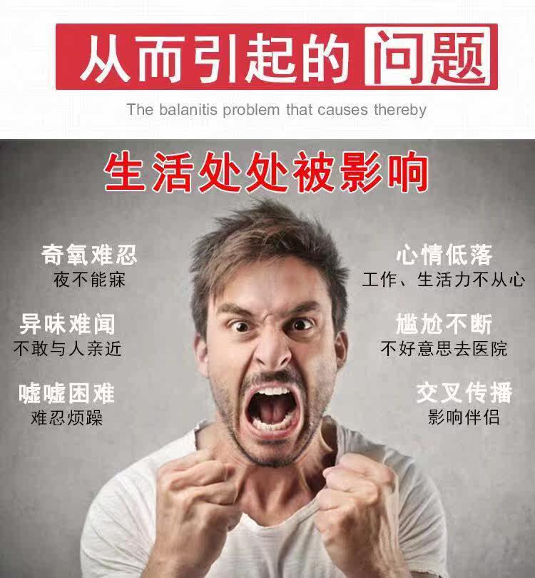 顽达康男士私处护理阴茎瘙痒止痒膏 峰健医疗器械皮肤消毒护理（消）