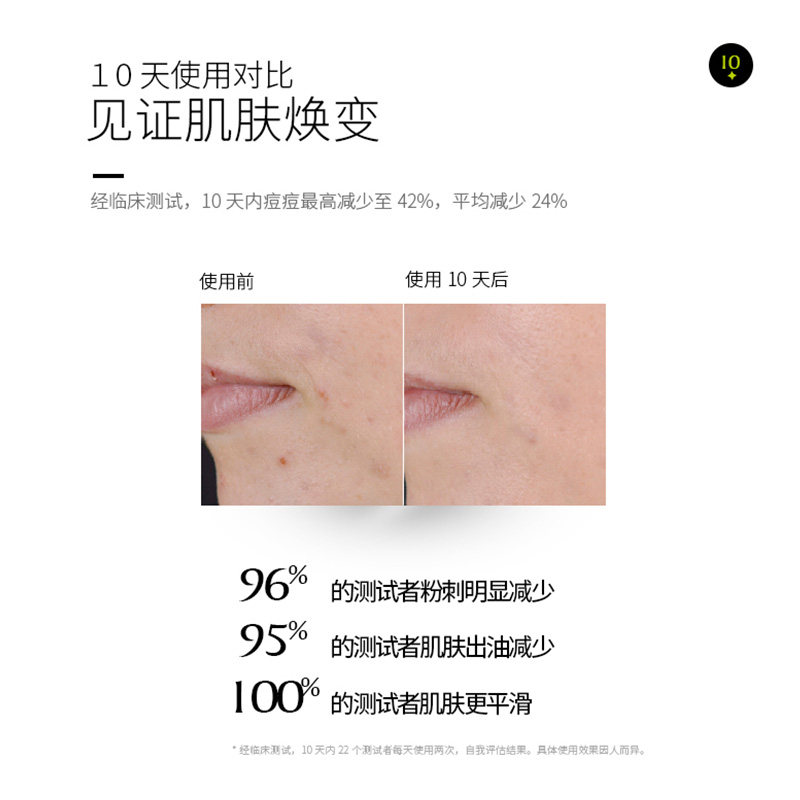 garancia面部精华闭口粉刺精华液 GARANCIA海外液态精华