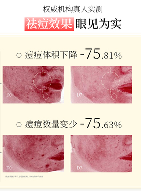 威格菲皮傲宁无酸祛痘精华液修护舒缓痘肌精华控油油痘敏肌可用