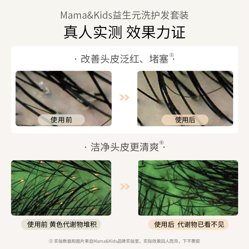 MamaKids益生元氨基酸头皮修护洗发液护发素孕妇专用洗护发套装