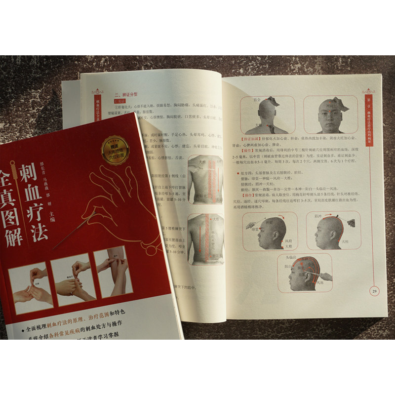 刺血疗法图解刺血疗法的原理中医针灸内科外科妇科儿科皮肤科骨伤科五官科常见病刺血疗法书中医刺血疗法科普读物图书籍_虎窝淘