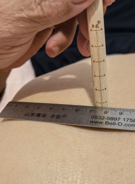 漏斗胸漏斗胸吸盘矫正丰歌准确胸