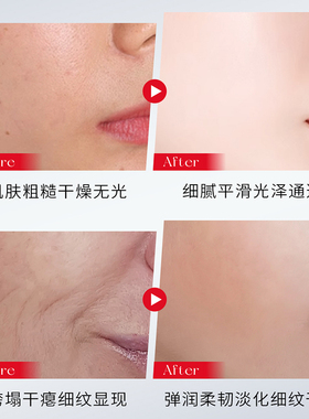 60片六胜肽抗皱紧致抗衰老面膜