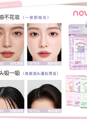NOVO清爽印花面部吸油纸100片女控油脸部便携去油纸妆面纸持妆