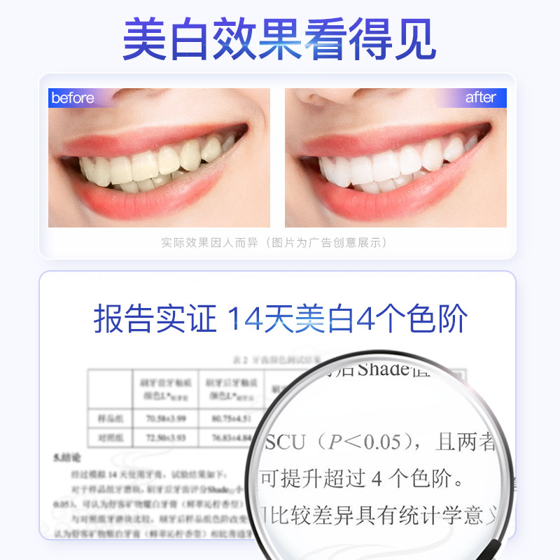 【香菇来了】舒客矿物精华美白清新牙膏套装-DB