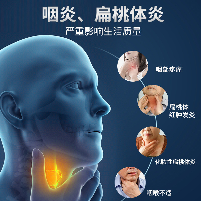 祖医堂咽扁康穴位贴慢性冷敷贴 雅映医疗器械膏药贴（器械）