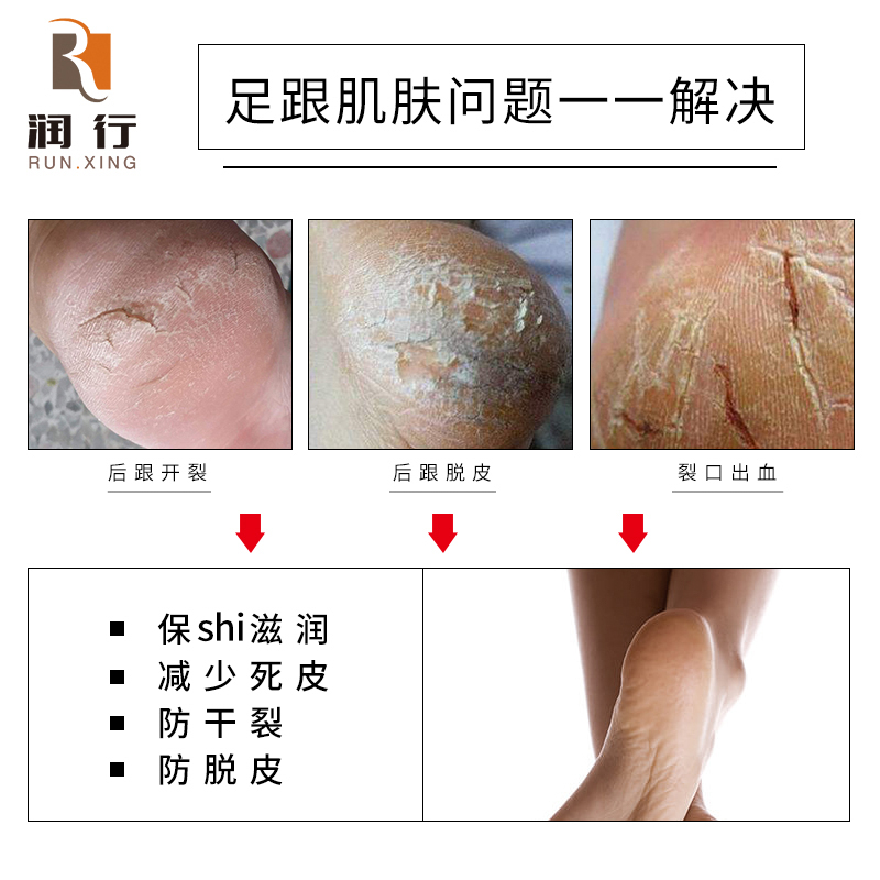 润行脚后跟保护套开裂干裂足护脚套防裂袜女男足跟疼痛防磨保湿袜