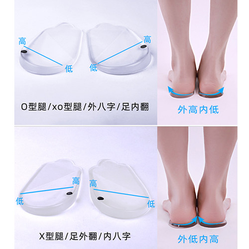 o型腿矫正鞋垫外翻儿童成人内外八字脚x腿型器纠正小腿xo直腿神器 - 图1