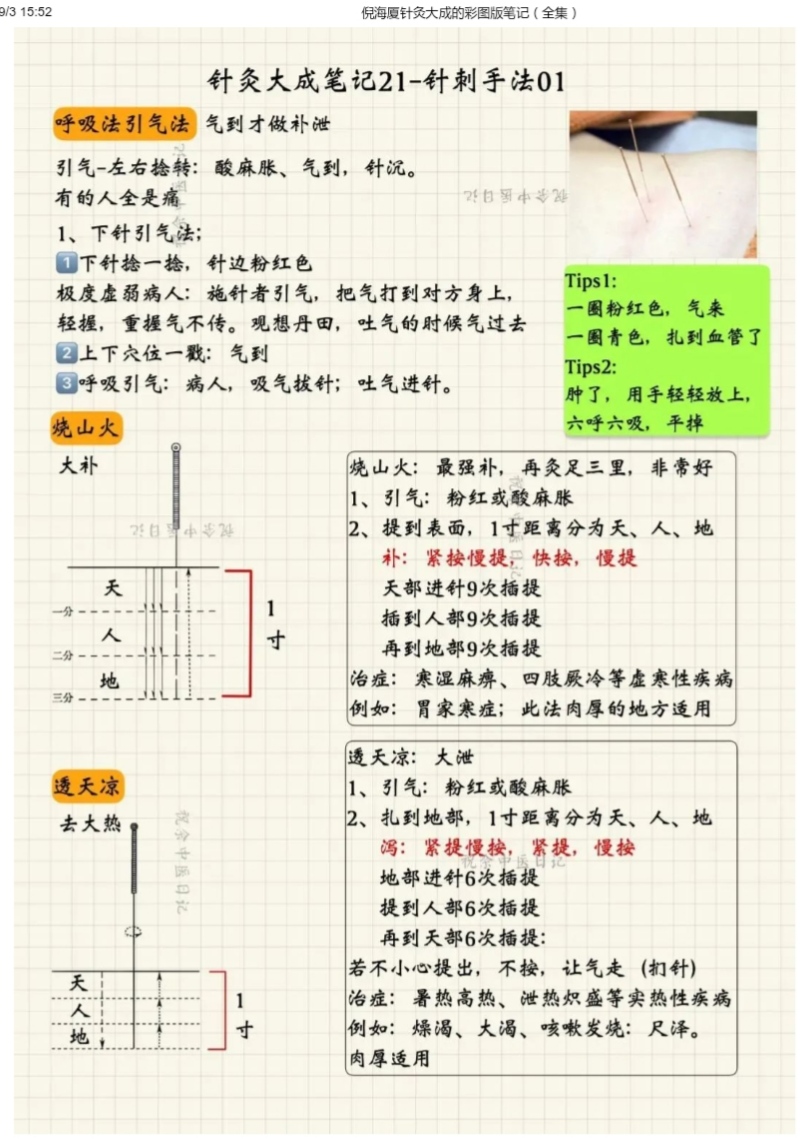 1.学习笔记针灸大成图文笔记高清 超高清图文笔记彩色版 入门 - 图2