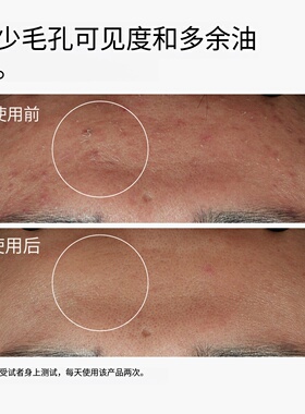 Theordinary10%烟酰胺1%锌精华