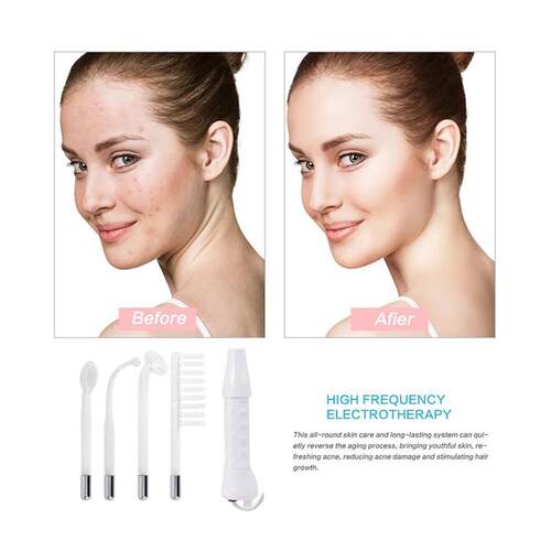 4In1 High Frequency Facial Wand Portable Electrotherapy电疗 - 图3