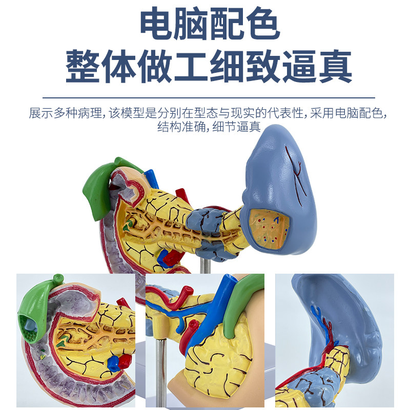 教学仿真病变胰脾肝胆十二指肠模型病理胰腺标本胰脾肝胆解剖_虎窝淘