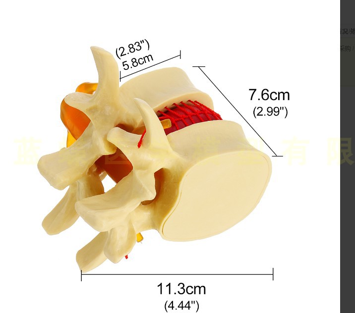 医学人体腰椎间盘受压演示模型 人体脊柱脊椎骨病理侧压突出演示 - 图3