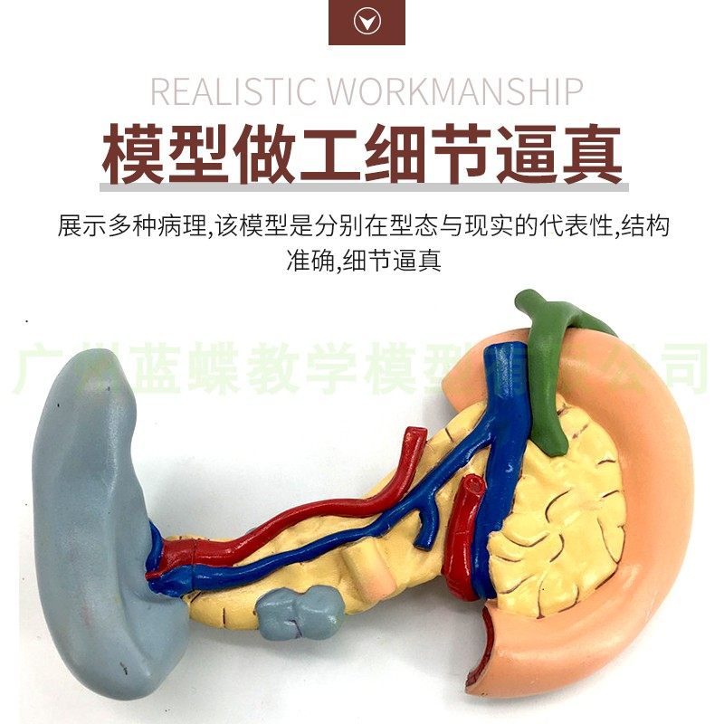 教学仿真病变胰脾肝胆十二指肠模型病理胰腺标本胰脾肝胆解剖_虎窝淘